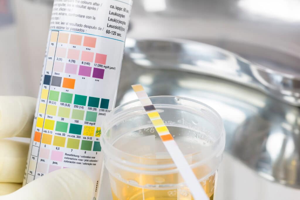 Urine samples and drug testing in a HGV medical - HGV Training Network